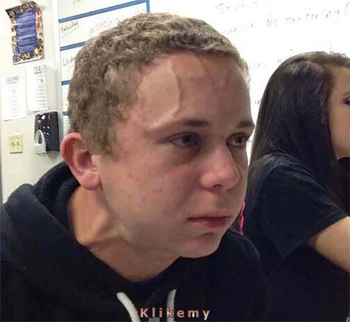 Lekarz radzi by pić dużo wody